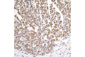Immunohistochemistry (IHC) image for anti-Heterogeneous Nuclear Ribonucleoprotein K (HNRNPK) (C-Term) antibody (ABIN7454660)