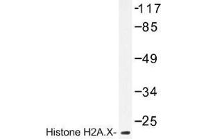 Image no. 1 for anti-H2A Histone Family, Member X (H2AFX) antibody (ABIN317781) (H2AFX anticorps)