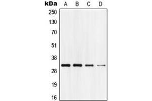 Western blot analysis of GPR18 expression in HEK293T (A), Jurkat (B), mouse brain (C), rat brain (D) whole cell lysates. (GPR18 anticorps  (Center))
