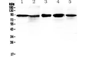 Western blot analysis of beta Catenin using anti-beta Catenin antibody . (CTNNB1 anticorps  (AA 2-233))