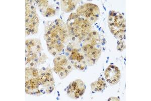Immunohistochemistry of paraffin-embedded human stomach using RAD23B antibody.