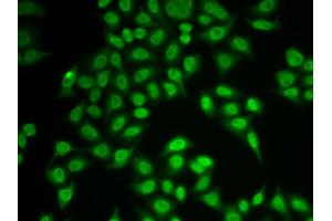 Immunofluorescence analysis of MCF-7 cells using PSMB9 antibody. (PSMB9 anticorps)