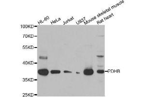 Western blot analysis of extracts of various cell lines, using PDHB antibody. (PDHB anticorps  (AA 1-300))