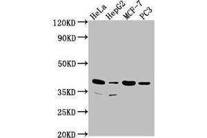 Western Blot Positive WB detected in: Hela whole cell lysate, HepG2 whole cell lysate, MCF-7 whole cell lysate, PC3 whole cell lysate All lanes: DUSP11 antibody at 1:2000 Secondary Goat polyclonal to rabbit IgG at 1/50000 dilution Predicted band size: 39, 26 kDa Observed band size: 39 kDa (DUSP11 anticorps  (AA 105-377))