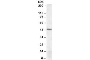 Western blot testing of MOLT4 lysate with DRAK2 antibody at 1ug/ml. (DRAK2 anticorps)
