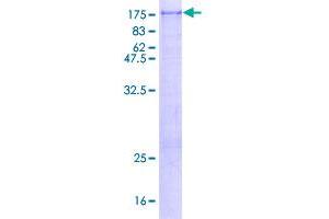 Image no. 1 for ArfGAP with SH3 Domain, Ankyrin Repeat and PH Domain 2 (ASAP2) (AA 1-1006) protein (GST tag) (ABIN1345787)
