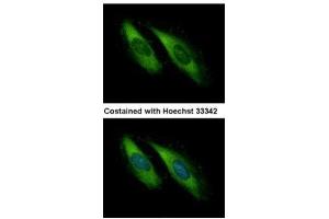anti-Unc-13 Homolog D (UNC13D) (C-Term) antibody