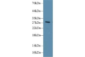 Western Blot; Sample: Rat Blood Cells lysate; Primary Ab: 1µg/ml Rabbit Anti-Rat DIO3 Antibody Second Ab: 0. (DIO3 anticorps  (AA 37-169))