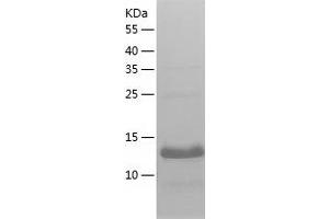 Western Blotting (WB) image for Hemoglobin, zeta (HBZ) (AA 1-142) protein (His-IF2DI Tag) (ABIN7123297)
