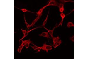 ABIN6274791 staining COLO205 by IF/ICC. (ABHD6 anticorps  (Internal Region))