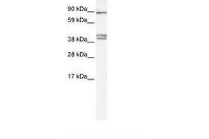 Image no. 1 for anti-Chloride Channel Kb (CLCNKB) (C-Term) antibody (ABIN6735456) (CLCNKB anticorps  (C-Term))