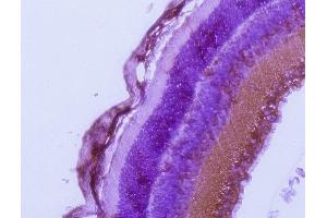 Immunohistochemistry (IHC) image for anti-RAB27A, Member RAS Oncogene Family (RAB27A) (C-Term) antibody (ABIN1440000)