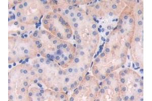 Detection of MB21D1 in Mouse Kidney Tissue using Polyclonal Antibody to Mab21 Domain Containing Protein 1 (MB21D1)