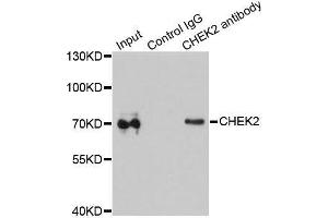 Immunoprecipitation analysis of 200ug extracts of MCF-7 cells using 1ug CHEK2 antibody.