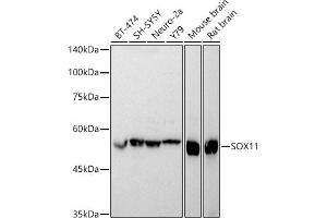 Western blot analysis of extracts of various cell lines, using SOX11 antibody (ABIN7270569) at 1:1000 dilution. (SOX11 anticorps)