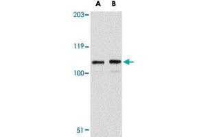 Western blot analysis of LRFN3 in K-562 cell lysate with LRFN3 polyclonal antibody  at (A) 1 and (B) 2 ug/mL . (LRFN3 anticorps  (Internal Region))