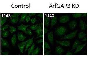 anti-ADP-Ribosylation Factor GTPase Activating Protein 3 (ARFGAP3) antibody