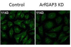 Immunofluorescence Microscopy of Rabbit Anti-ArfGAP3 Antibody. (ARFGAP3 anticorps)