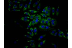 anti-Eukaryotic Translation Initiation Factor 4A1 (EIF4A1) antibody