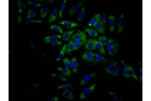 Immunofluorescence staining of Hela Cells with ABIN7127468 at 1:50, counter-stained with DAPI. (Recombinant EIF4A1 anticorps)