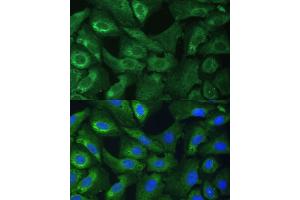 Immunofluorescence analysis of U-2 OS cells using EIF3G Polyclonal Antibody (ABIN1679693, ABIN3018723, ABIN3018724 and ABIN6220556) at dilution of 1:100 (40x lens).