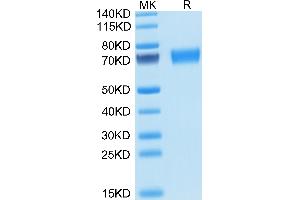 Mouse AXL on Tris-Bis PAGE under reduced condition.