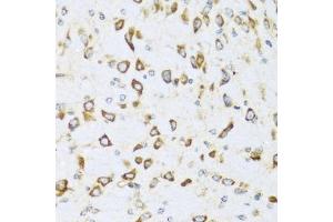 Immunohistochemistry of paraffin-embedded mouse brain using NRG4 antibody (ABIN3016309, ABIN3016310, ABIN3016311 and ABIN6219713) at dilution of 1:100 (40x lens).