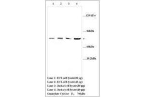 Image no. 1 for anti-Guanylate Cyclase 1, Soluble, beta 3 (GUCY1B3) (AA 188-207) antibody (ABIN791333) (GUCY1B3 anticorps  (AA 188-207))