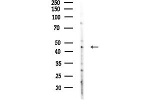 anti-Keratin 23 (KRT23) (N-Term) antibody