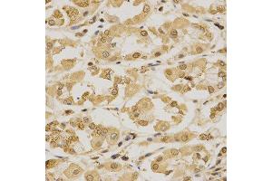 Immunohistochemistry (IHC) image for anti-Small Ubiquitin Related Modifier Protein 1 (SUMO1) (AA 1-101) antibody (ABIN3022994) (SUMO1 anticorps  (AA 1-101))