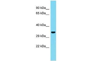 Host: Rabbit Target Name: CCDC75 Sample Type: Fetal Kidney lysates Antibody Dilution: 1. (CCDC75 anticorps  (N-Term))