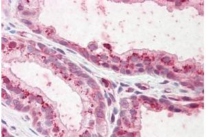 Human Prostate: Formalin-Fixed, Paraffin-Embedded (FFPE) (Plakophilin 2 anticorps  (AA 125-139))