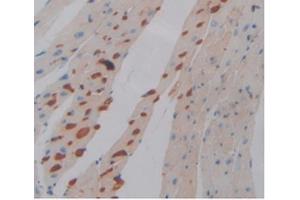 IHC-P analysis of Mouse Heart Tissue, with DAB staining. (PD-L1 anticorps  (AA 48-290))