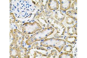 Immunohistochemistry of paraffin-embedded Rat kidney using SLC4A4 / NBC Polyclonal Antibody at dilution of 1:100 (40x lens). (SLC4A4 anticorps)