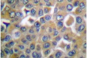 Image no. 2 for anti-Protein tyrosine Phosphatase, Non-Receptor Type 13 (APO-1/CD95 (Fas)-Associated Phosphatase) (PTPN13) antibody (ABIN265414)