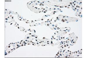 Immunohistochemical staining of paraffin-embedded lung tissue using anti-NTRK2mouse monoclonal antibody.