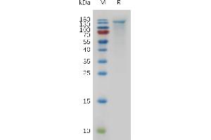 Mouse CEA Protein, His Tag on SDS-PAGE under reducing condition.
