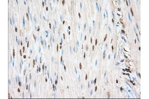 Immunohistochemical staining of paraffin-embedded Human liver tissue using anti-PIM2 mouse monoclonal antibody. (PIM2 anticorps)