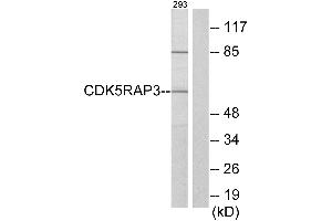 Western blot analysis of extracts from 293 cells, using CDK5RAP3 antibody. (CDK5RAP3 anticorps)