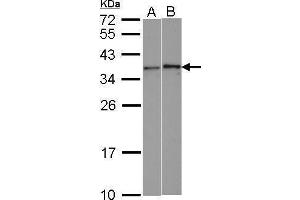 WB Image Sample (30 ug of whole cell lysate) A: HeLa B: HCT116 12% SDS PAGE antibody diluted at 1:1000