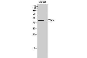 Western Blotting (WB) image for anti-Protein Phosphatase, Mg2+/Mn2+ Dependent, 1L (PPM1L) (Internal Region) antibody (ABIN3186533)