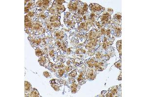 Immunohistochemistry of paraffin-embedded rat pancreas using PNLIPRP1 antibody (ABIN7269167) at dilution of 1:100 (40x lens). (PNLIPRP1 anticorps  (AA 298-467))