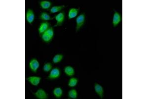 Immunofluorescence staining of A549 cells with ABIN7152326 at 1:200, counter-stained with DAPI.