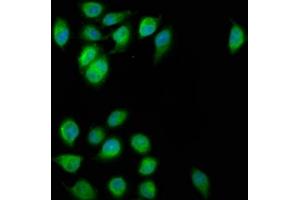 Immunofluorescence staining of A549 cells with ABIN7152326 at 1:200, counter-stained with DAPI. (FAM62B anticorps  (AA 567-736))