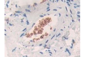 Detection of BND3 in Human Liver Tissue using Polyclonal Antibody to Band 3 (BND3)