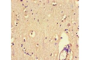 Immunohistochemistry of paraffin-embedded human brain tissue using ABIN7167518 at dilution of 1:100 (PTPRS anticorps  (AA 25-128))