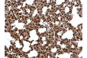IHC-P Image Proteasome 20S alpha 6 antibody detects Proteasome 20S alpha 6 protein at cytosol and nucleus on mouse lung by immunohistochemical analysis.