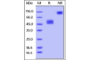 Biotinylated Mouse BAFFR /TNFRSF13C, Fc Tag, Avi Tag (Avitag™) on SDS-PAGE under reducing (R) and no-reducing (NR) conditions.