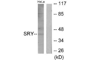 Western Blotting (WB) image for anti-Sex Determining Region Y (SRY) (Internal Region) antibody (ABIN1849548) (SRY anticorps  (Internal Region))