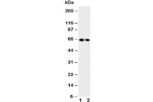 Western blot testing of CaMKK2 antibody and Lane 1:  rat brain;  2: mouse brain
